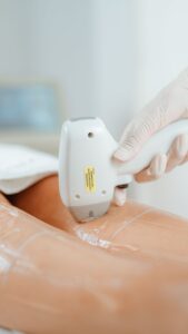 Epilator i test 2026