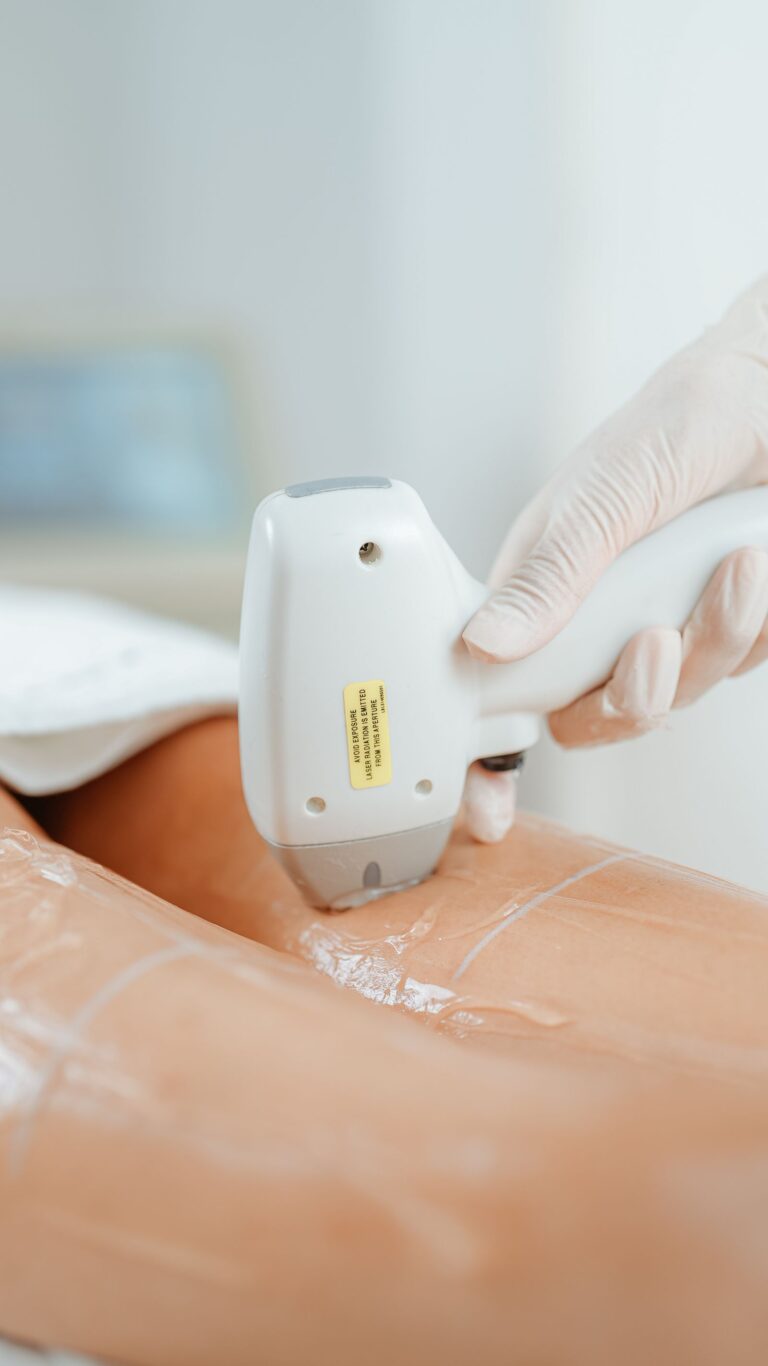 Epilator i test 2026